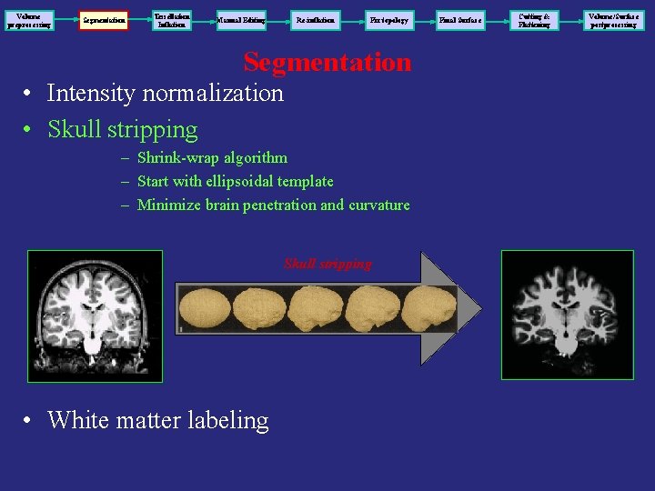 Volume preprocessing Segmentation Tessellation Inflation Manual Editing Re-inflation Fix topology Segmentation • Intensity normalization
