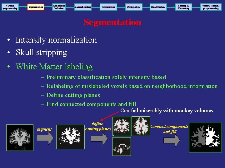 Volume preprocessing Tessellation Inflation Segmentation Manual Editing Re-inflation Fix topology Final Surface Cutting &