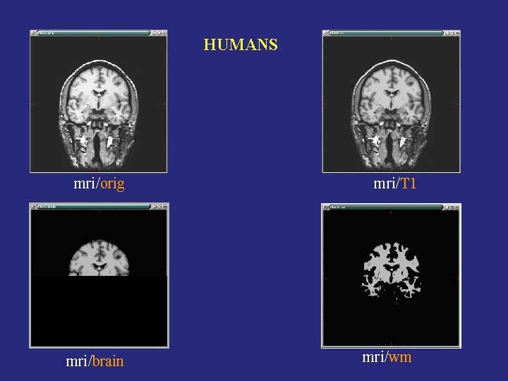 HUMANS mri/orig mri/brain mri/T 1 mri/wm 