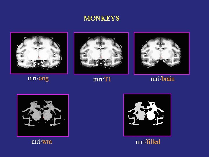 MONKEYS mri/orig mri/wm mri/T 1 mri/brain mri/filled 