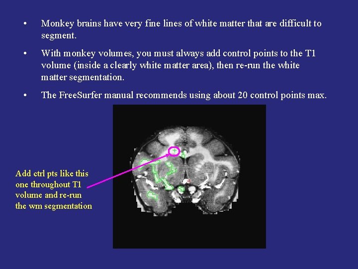  • Monkey brains have very fine lines of white matter that are difficult