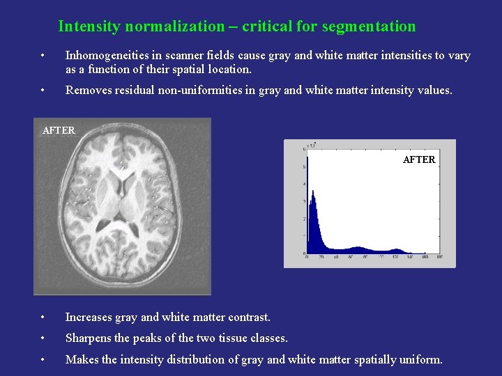 Intensity normalization – critical for segmentation • Inhomogeneities in scanner fields cause gray and