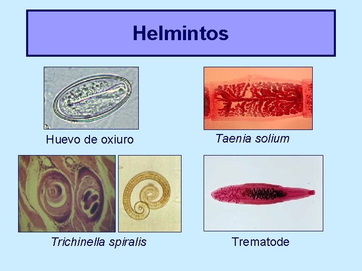 Helmintos Huevo de oxiuro Trichinella spiralis Taenia solium Trematode 