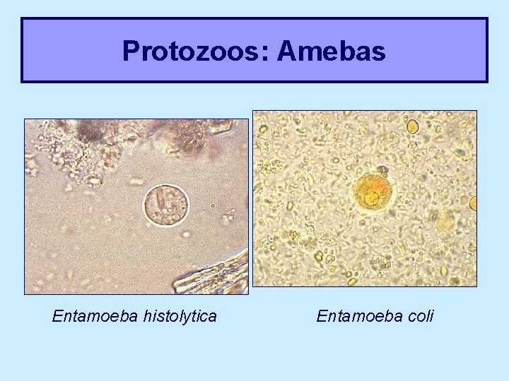 Protozoos: Amebas Entamoeba histolytica Entamoeba coli 