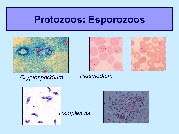 Protozoos: Esporozoos Cryptosporidium Plasmodium Toxoplasma 
