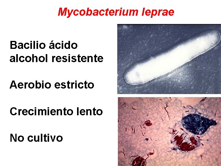 Mycobacterium leprae Bacilio ácido alcohol resistente Aerobio estricto Crecimiento lento No cultivo 