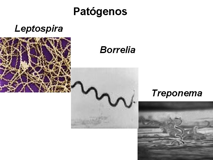 Patógenos Leptospira Borrelia Treponema 