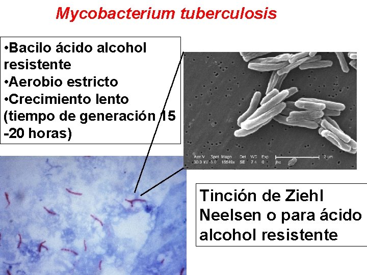 Mycobacterium tuberculosis • Bacilo ácido alcohol resistente • Aerobio estricto • Crecimiento lento (tiempo