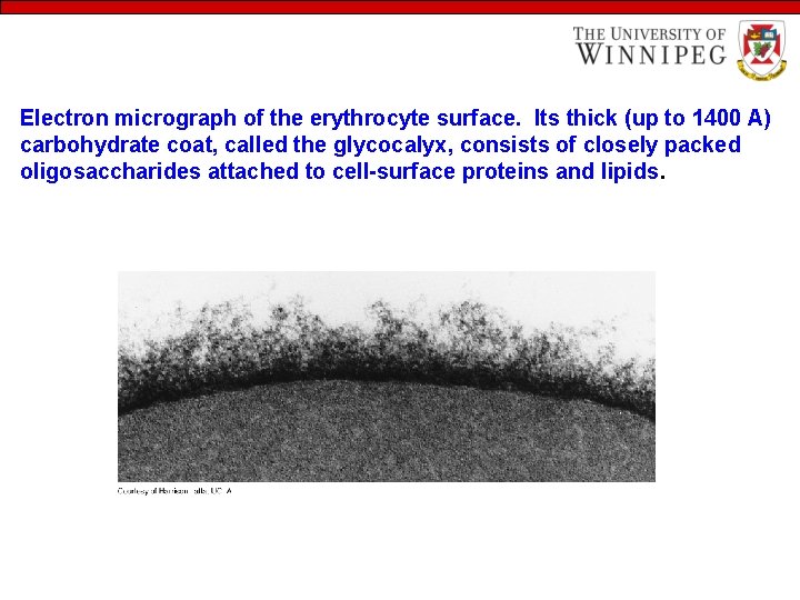 Electron micrograph of the erythrocyte surface. Its thick (up to 1400 A) carbohydrate coat,