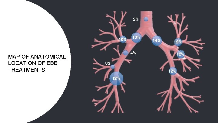 2% 10% MAP OF ANATOMICAL LOCATION OF EBB TREATMENTS 13% 4% 12% 12% 3%