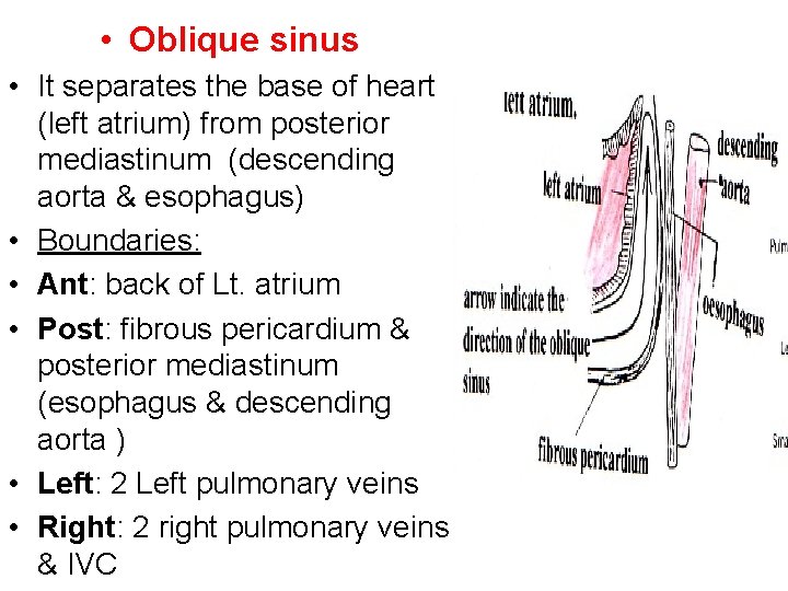  • Oblique sinus • It separates the base of heart (left atrium) from