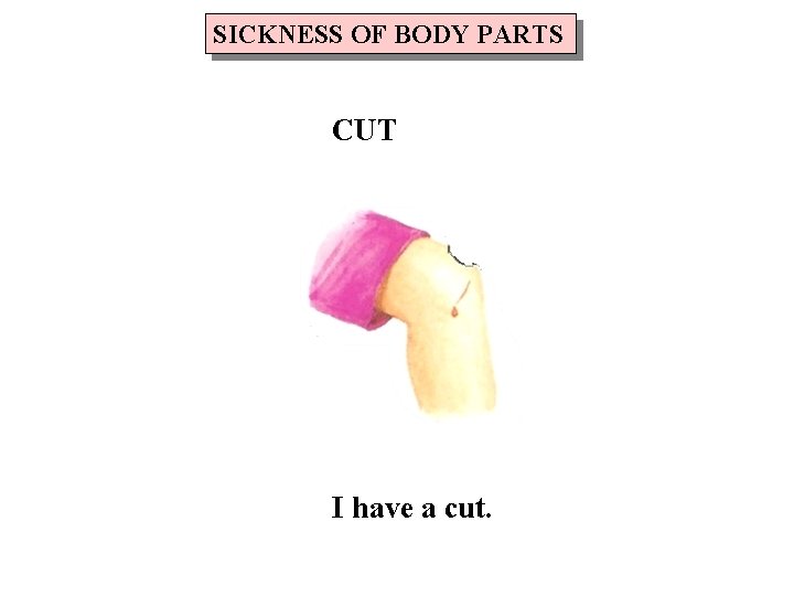 SICKNESS OF BODY PARTS CUT I have a cut. 