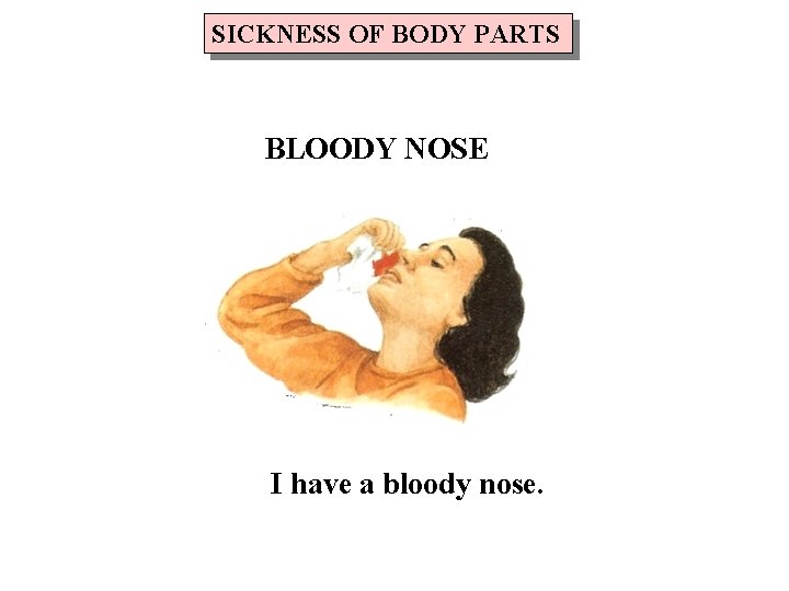 SICKNESS OF BODY PARTS BLOODY NOSE I have a bloody nose. 