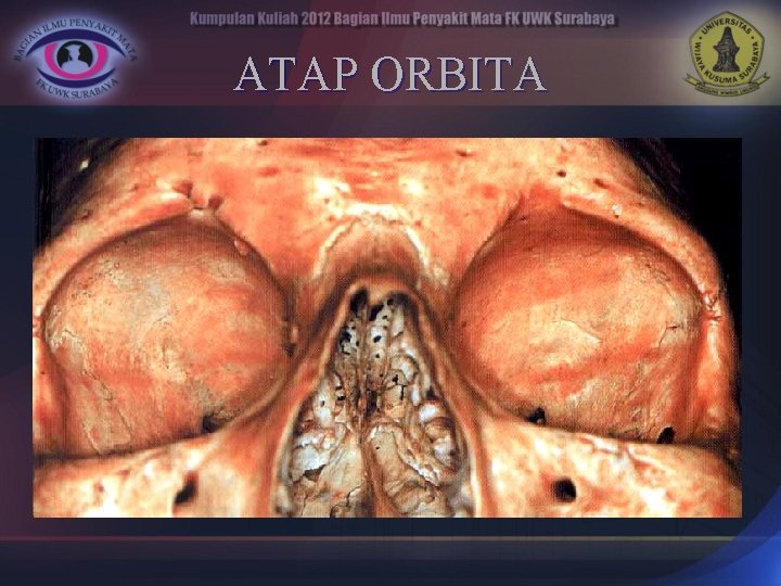 ATAP ORBITA 