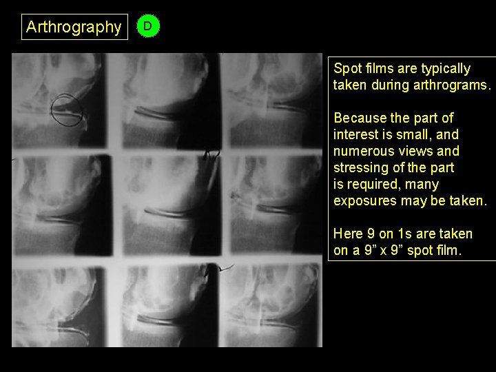 Arthrography D Spot films are typically taken during arthrograms. Because the part of interest