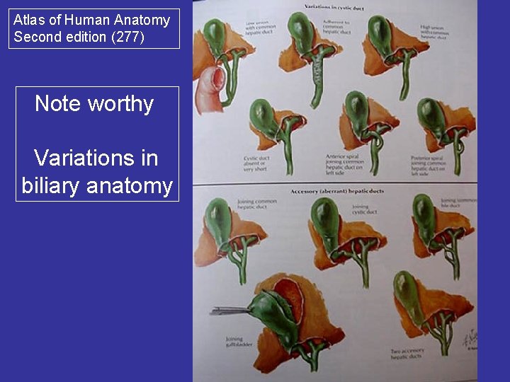 Atlas of Human Anatomy Second edition (277) Note worthy Variations in biliary anatomy 