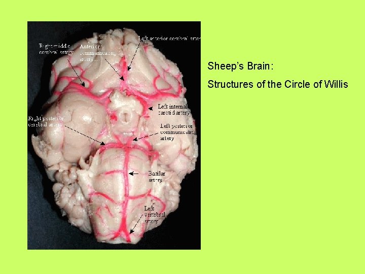 Sheep’s Brain: Structures of the Circle of Willis 