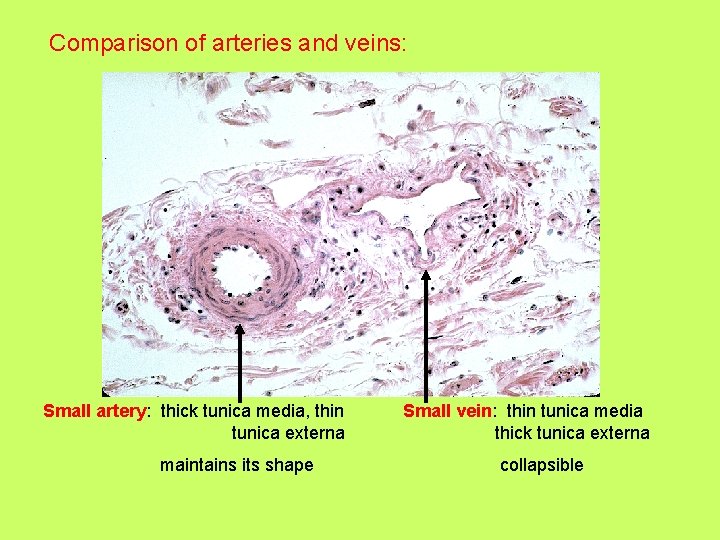 Comparison of arteries and veins: Small artery: thick tunica media, thin tunica externa maintains