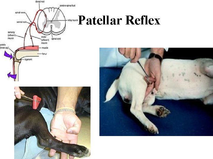 Patellar Reflex 