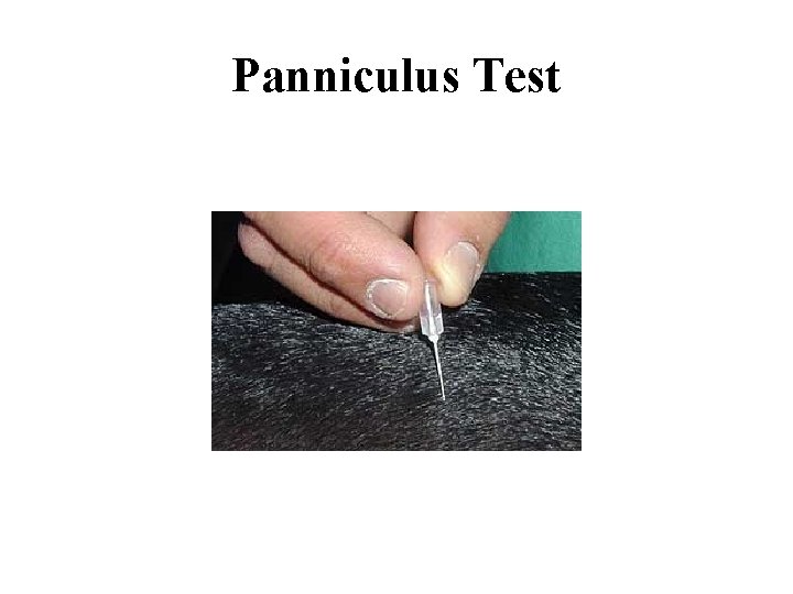 Panniculus Test 