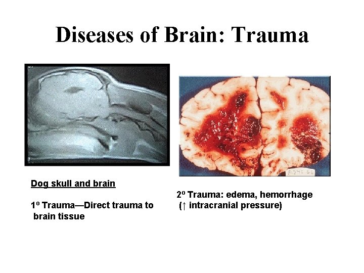 Diseases of Brain: Trauma Dog skull and brain 1º Trauma—Direct trauma to brain tissue