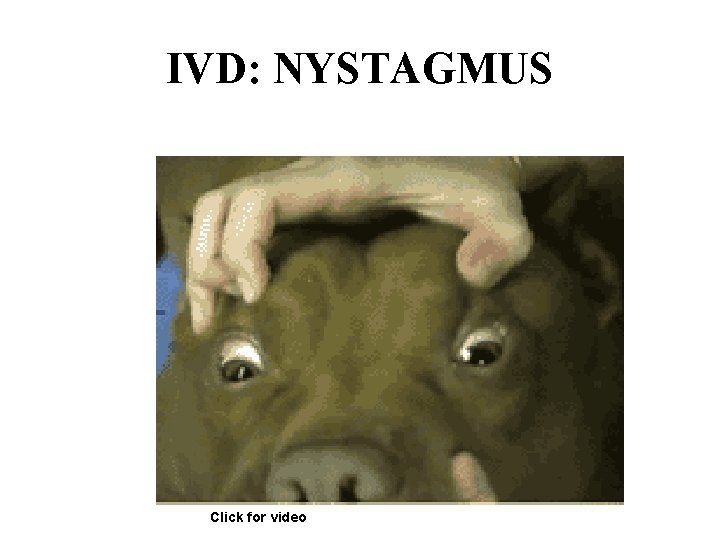 IVD: NYSTAGMUS Click for video 