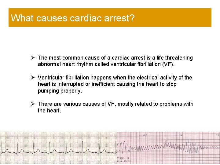 What causes cardiac arrest? Ø The most common cause of a cardiac arrest is