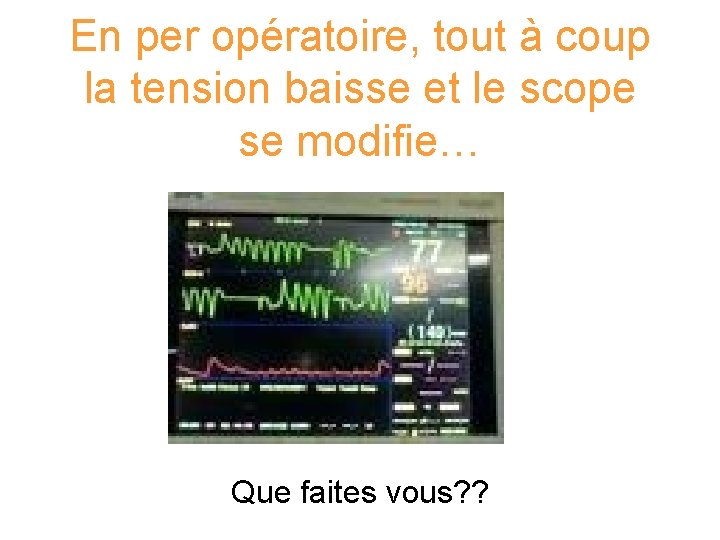 En per opératoire, tout à coup la tension baisse et le scope se modifie…