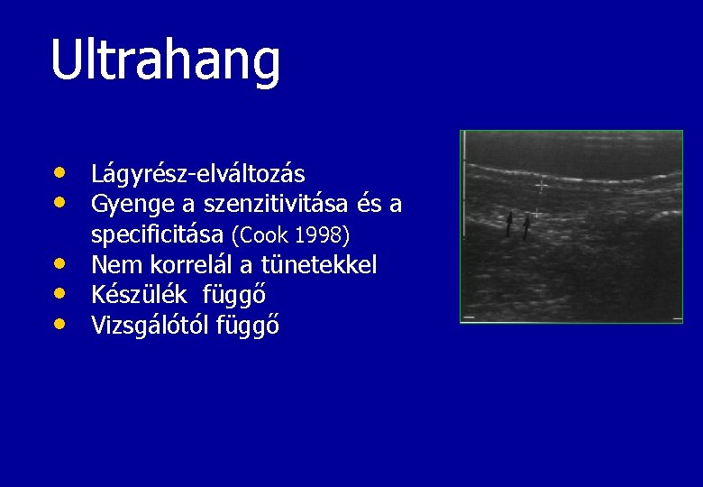 Ultrahang • Lágyrész-elváltozás • Gyenge a szenzitivitása és a • • • specificitása (Cook