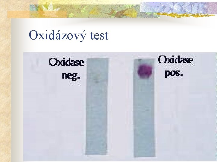 Oxidázový test 