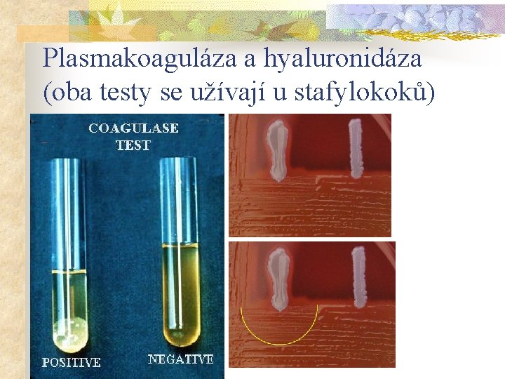 Plasmakoaguláza a hyaluronidáza (oba testy se užívají u stafylokoků) 