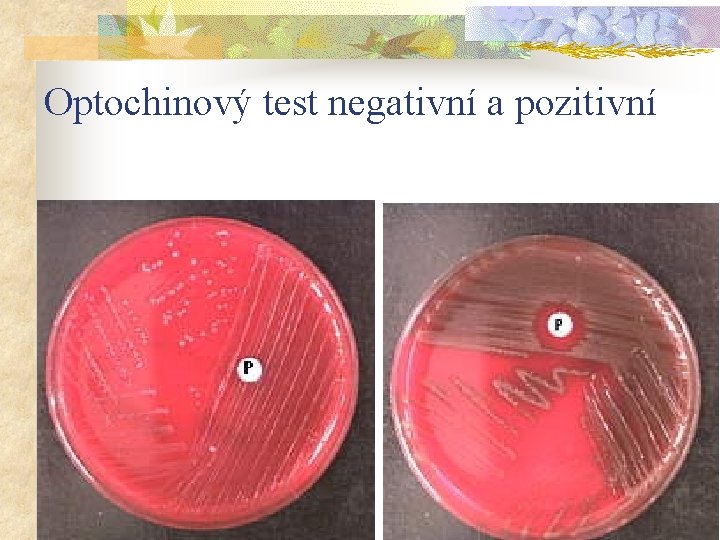 Optochinový test negativní a pozitivní 