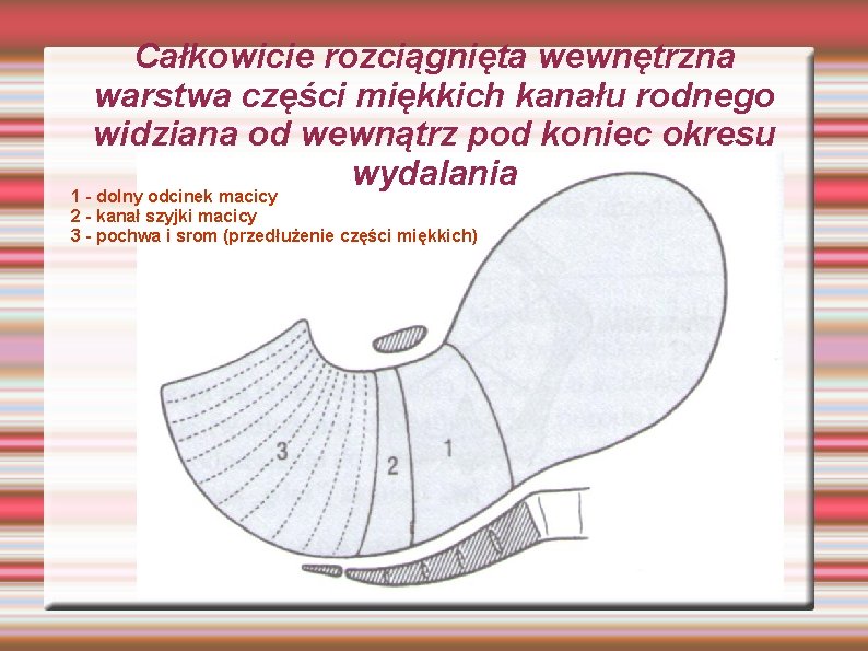 Całkowicie rozciągnięta wewnętrzna warstwa części miękkich kanału rodnego widziana od wewnątrz pod koniec okresu Całkowicie rozciągnięta wewnętrzna warstwa części miękkich kanału rodnego widziana od wewnątrz pod koniec okresu