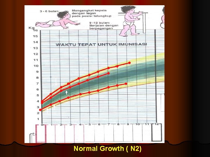 Normal Growth ( N 2) 