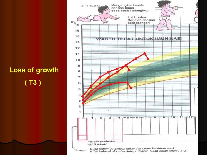 Loss of growth ( T 3 ) 