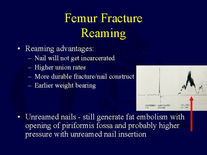 Femur Fracture Reaming • Reaming advantages: – – Nail will not get incarcerated Higher