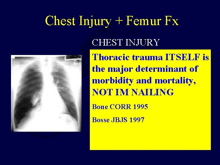 Chest Injury + Femur Fx CHEST INJURY • Thoracic Increased pulmonary trauma ITSELF is