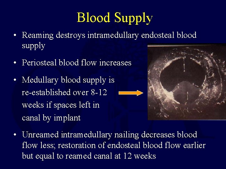 Blood Supply • Reaming destroys intramedullary endosteal blood supply • Periosteal blood flow increases