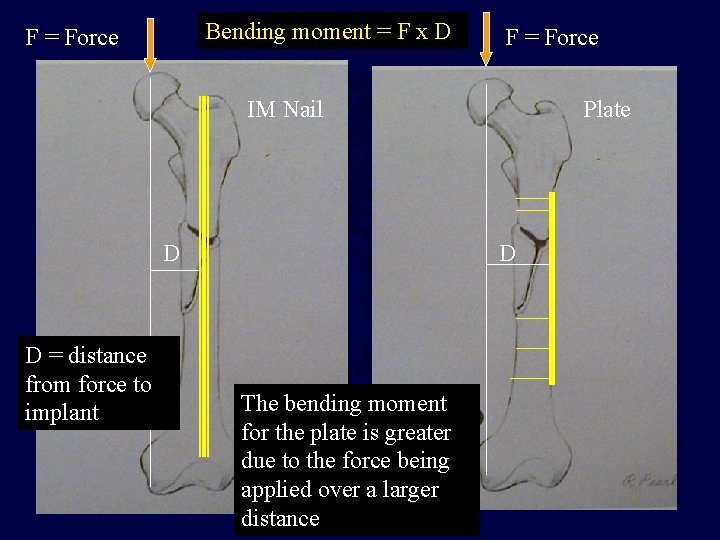 Bending moment = F x D F = Force IM Nail D D =