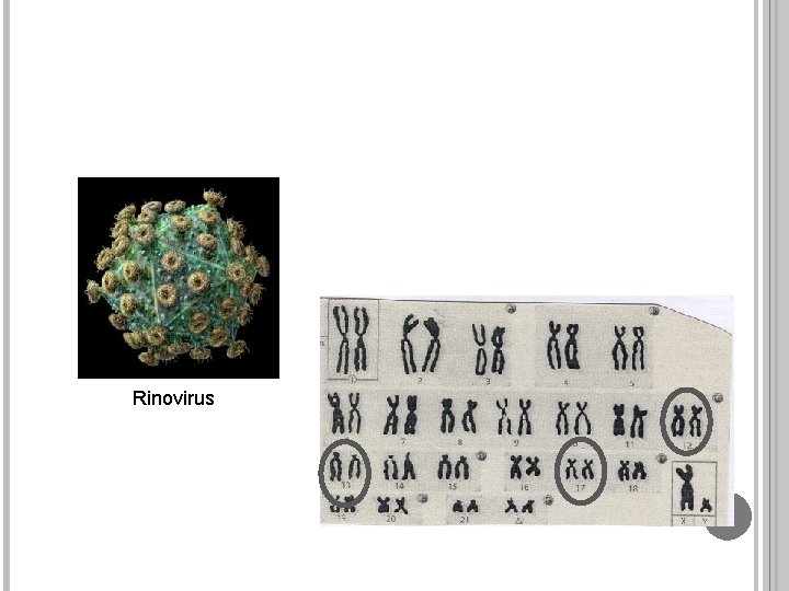 Rinovirus 