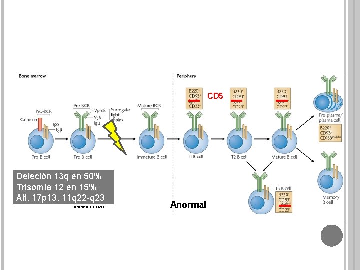 CD 5 Deleción 13 q en 50% Trisomía 12 en 15% Alt. 17 p