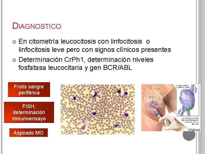 DIAGNOSTICO En citometría leucocitosis con linfocitosis o linfocitosis leve pero con signos clínicos presentes