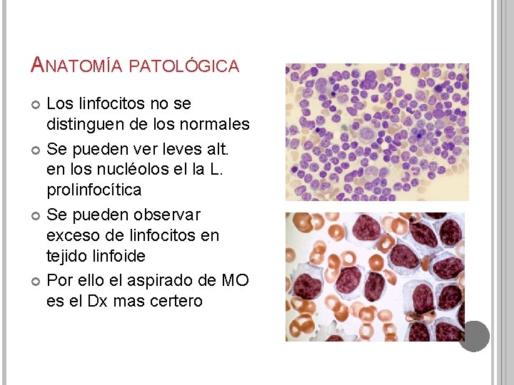 ANATOMÍA PATOLÓGICA Los linfocitos no se distinguen de los normales Se pueden ver leves