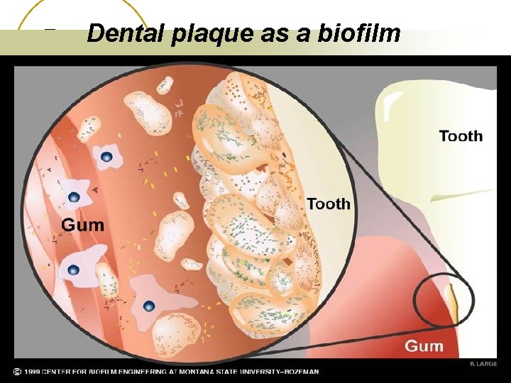 Dental plaque as a biofilm 