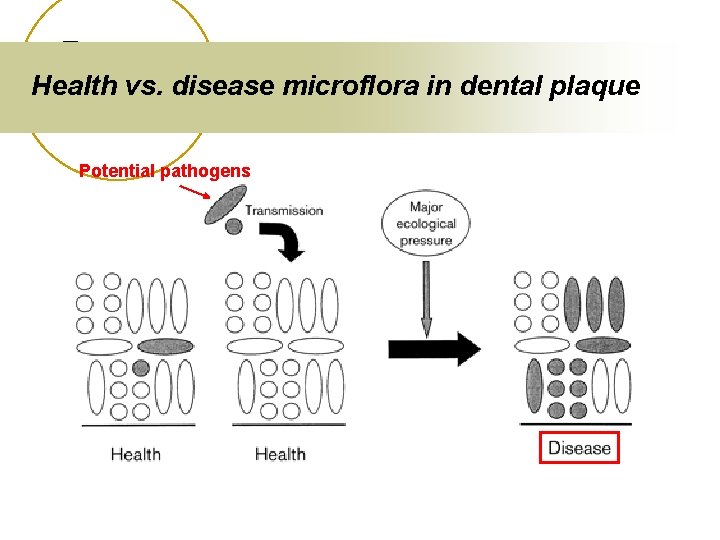 Health vs. disease microflora in dental plaque Potential pathogens 