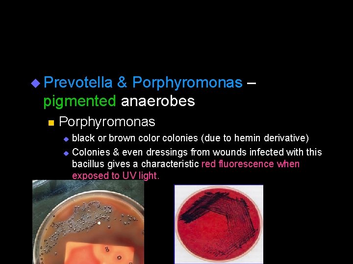 u Prevotella & Porphyromonas – pigmented anaerobes n Porphyromonas black or brown color colonies