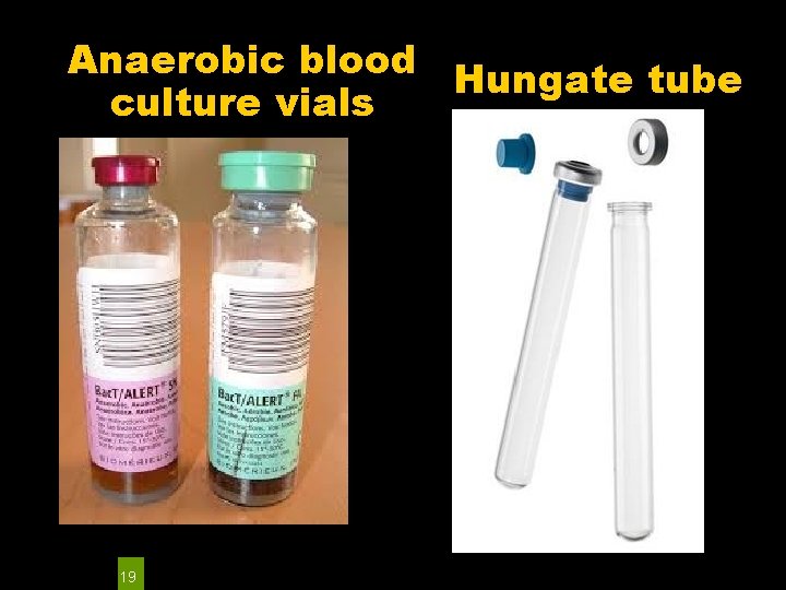 Anaerobic blood Hungate tube culture vials 19 