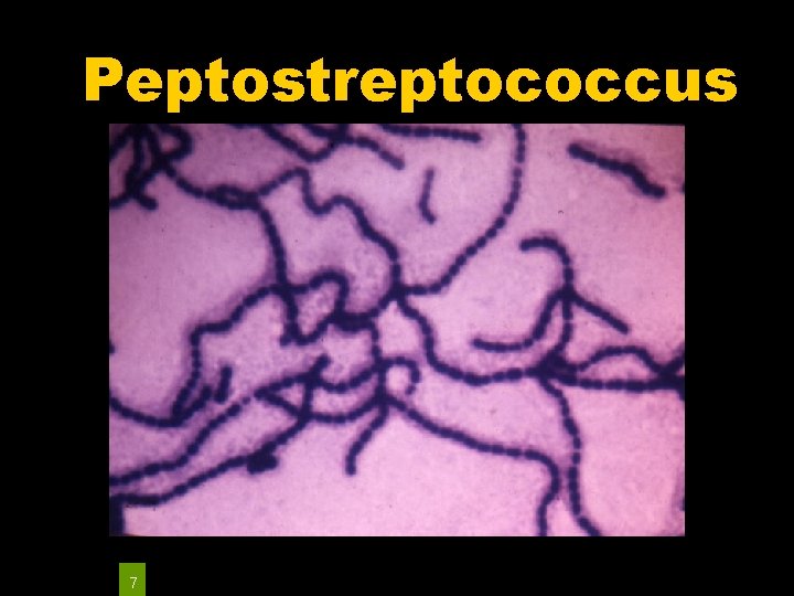 Peptostreptococcus 7 