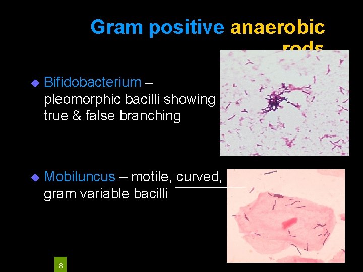 Gram positive anaerobic rods u Bifidobacterium – pleomorphic bacilli showing true & false branching