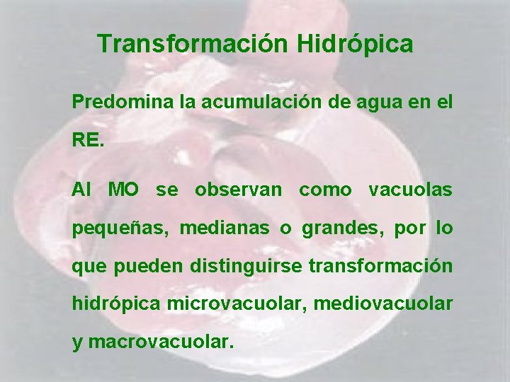 Transformación Hidrópica Predomina la acumulación de agua en el RE. Al MO se observan